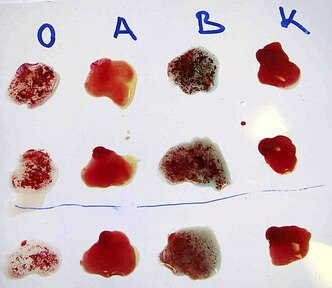 ABO式血液型の画像